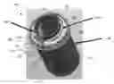 Fig. 01 - Graft filter with locking graft filter element and graft extractor