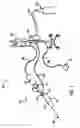 Fig. 02 - Vibrational catheter devices and methods for making same