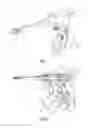 Fig. 02 - Vessel sealer and divider