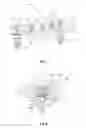 Fig. 02 - DENTAL COMPONENT FOR A DENTAL RESTORATION AND METHOD FOR ASSEMBLING THE DENTAL COMPONENT