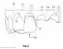 Fig. 04 - Tooth unit and method for producing denture base