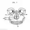 Fig. 09 - PROSTHESIS FOR NOSE SURGERY