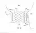 Fig. 09 - Transcatheter mitral valve stent frames