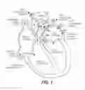 Fig. 02 - Expandable frames and paravalvular leak mitigation systems for implantable prosthetic heart valve devices