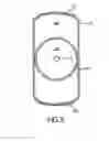 Fig. 04 - Percutaneous implantable nuclear prosthesis