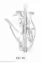 Fig. 37 - Bone graft delivery system and method for using same