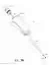 Fig. 49 - Bone graft delivery system and method for using same