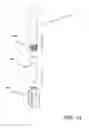 Fig. 64 - Bone graft delivery system and method for using same
