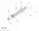 Fig. 71 - Bone graft delivery system and method for using same