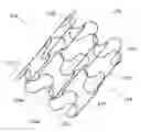 Fig. 01 - Stent device having reduced foreshortening and recoil and method of making same