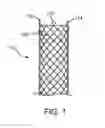 Fig. 02 - STENT HAVING AN ANCHOR FOR TISSUE INGROWTH