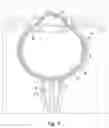 Fig. 02 - Shunt system, shunt and method for treating an ocular disorder