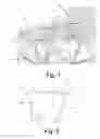Fig. 02 - Gravity reactive braking systems for wheels