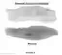 Fig. 05 - Compositions and methods for topical application and transdermal delivery of botulinum toxins