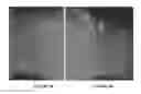 Fig. 08 - Compositions and methods for topical application and transdermal delivery of botulinum toxins