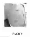 Fig. 09 - Compositions and methods for topical application and transdermal delivery of botulinum toxins