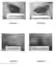 Fig. 12 - Compositions and methods for topical application and transdermal delivery of botulinum toxins