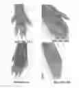 Fig. 14 - Compositions and methods for topical application and transdermal delivery of botulinum toxins