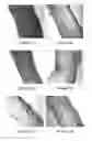 Fig. 20 - Compositions and methods for topical application and transdermal delivery of botulinum toxins