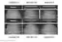 Fig. 22 - Compositions and methods for topical application and transdermal delivery of botulinum toxins