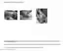 Fig. 06 - Wound healing composition
