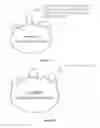 Fig. 12 - Chimeric norovirus P particle and preparation and use thereof