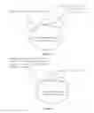 Fig. 15 - Chimeric norovirus P particle and preparation and use thereof
