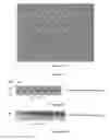 Fig. 20 - Chimeric norovirus P particle and preparation and use thereof