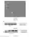 Fig. 25 - Chimeric norovirus P particle and preparation and use thereof