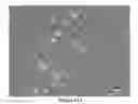 Fig. 27 - Chimeric norovirus P particle and preparation and use thereof