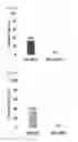 Fig. 09 - Recombinant vaccinia virus and use thereof
