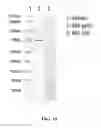 Fig. 20 - CMV vaccines