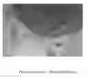 Fig. 01 - Compositions and methods for treating Crohn's disease and related conditions and infections