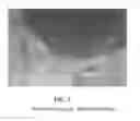 Fig. 02 - Compositions and methods for treating Crohn's disease and related conditions and infections