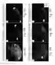 Fig. 16 - Neuronal enhancers