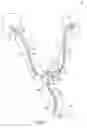 Fig. 02 - Ureteral and bladder catheters and methods of inducing negative pressure to increase renal perfusion