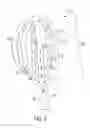 Fig. 09 - Ureteral and bladder catheters and methods of inducing negative pressure to increase renal perfusion