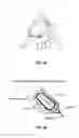 Fig. 02 - WIRELESS GUIDEWIRE