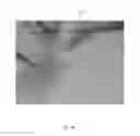 Fig. 85 - Integrated sealing and securing device for vascular catheters and methods for use of same