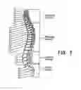 Fig. 04 - System and method for treatment of pain related to limb joint replacement surgery