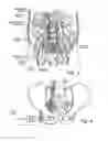 Fig. 05 - System and method for treatment of pain related to limb joint replacement surgery