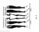 Fig. 06 - System and method for treatment of pain related to limb joint replacement surgery