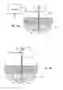 Fig. 07 - System and method for treatment of pain related to limb joint replacement surgery