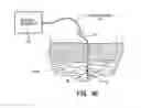 Fig. 08 - System and method for treatment of pain related to limb joint replacement surgery