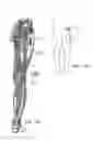 Fig. 12 - System and method for treatment of pain related to limb joint replacement surgery