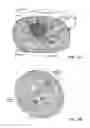 Fig. 13 - System and method for treatment of pain related to limb joint replacement surgery