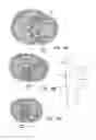 Fig. 14 - System and method for treatment of pain related to limb joint replacement surgery