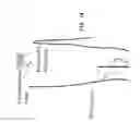 Fig. 15 - System and method for treatment of pain related to limb joint replacement surgery