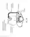 Fig. 17 - System and method for treatment of pain related to limb joint replacement surgery