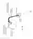 Fig. 18 - System and method for treatment of pain related to limb joint replacement surgery